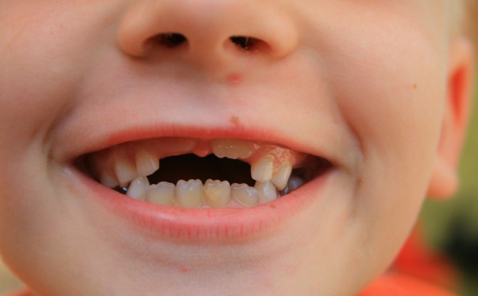 precio Oh querido Escuela primaria El orden de caída de los dientes de leche en los niños | Inmaculada Cordón